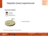 Hepatitis (ever) experienced: paediatric patients, haemophilia A