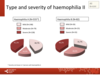 Type and severity of haemophilia in all patients: haemophilia A, haemophilia B