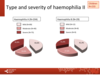 Type and severity of haemophilia in paediatric patients: haemophilia A, haemophilia B