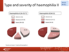 Type and severity of haemophilia in adults: haemophilia A, haemophilia B